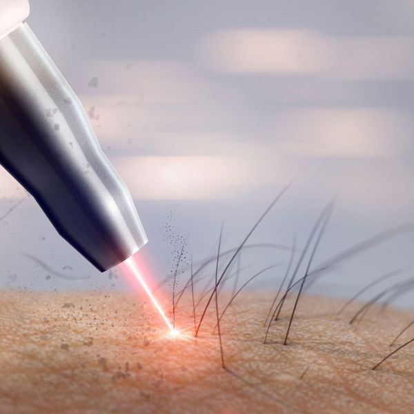Close up of laser hair removal