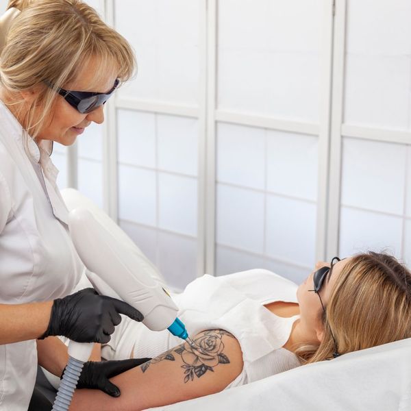 women receiving tattoo removal