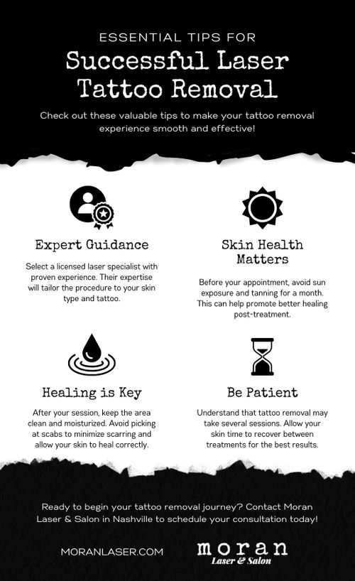 M24620 - Infographic - Tips for Successful Laser Tattoo Removal.jpg