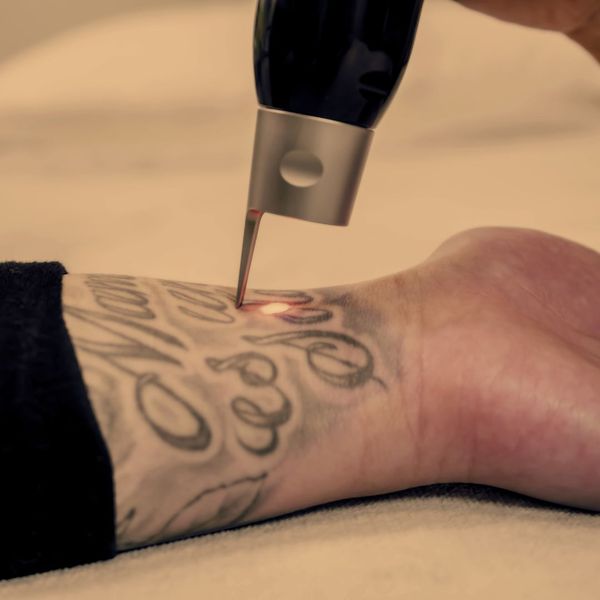 Blog - Tattoo Removal for Different Ink Colors.Image3.jpg