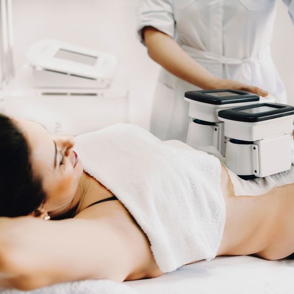 CoolSculpting treatment