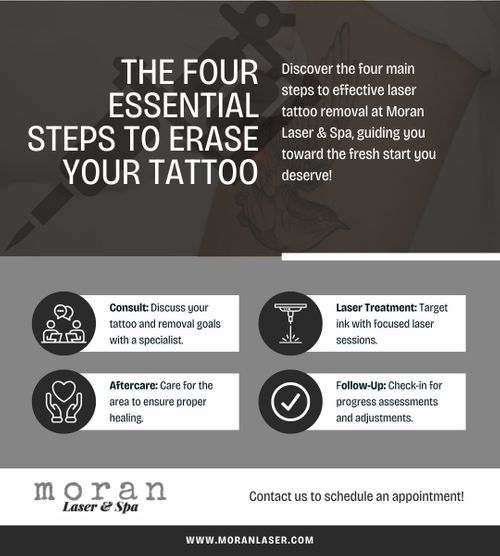 M24620 - Infographic- The Complete Guide to Laser Tattoo Removal.jpg