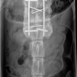 image of a x-ray