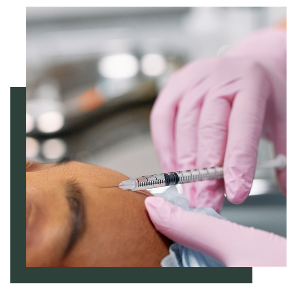 Forehead filler