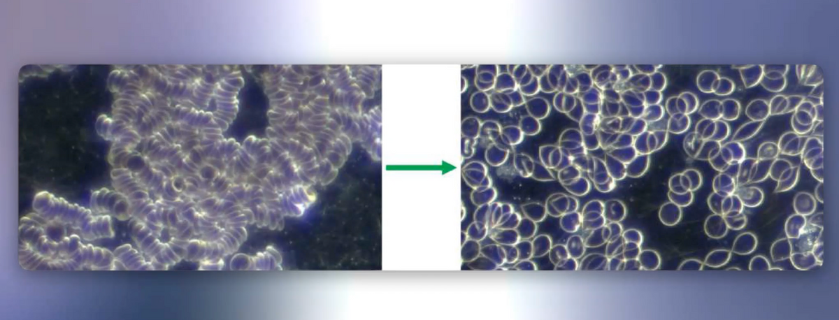 blood changes #2.png