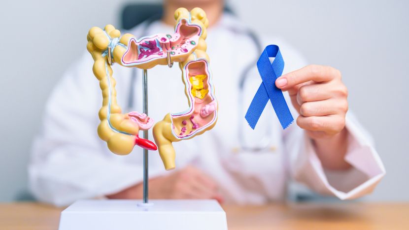 Prioritizing Your Health The Crucial Role of Colon Cancer Screening.jpg