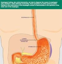 Esophageal image 1.jpg
