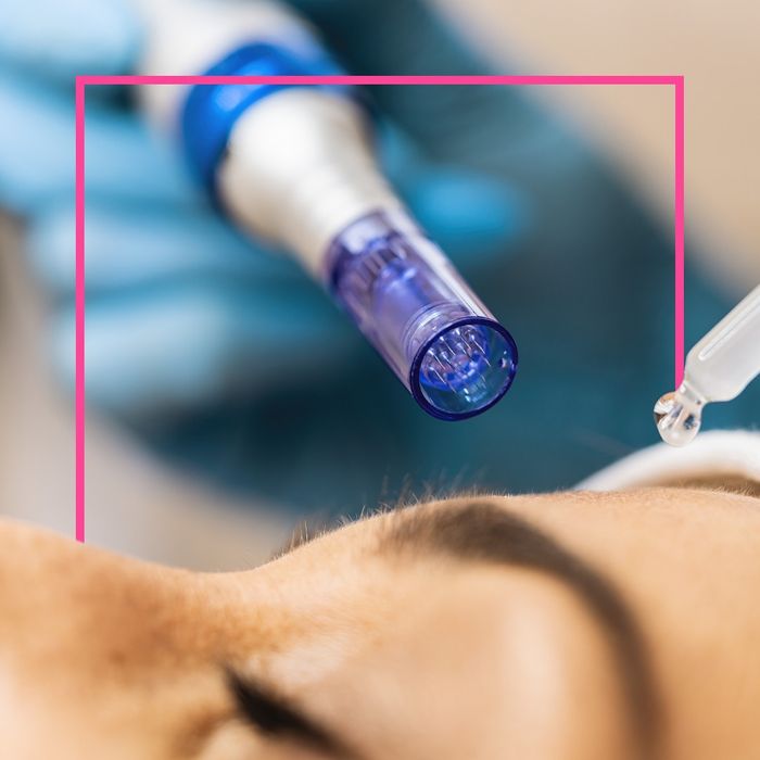 Micro-Needling - Image 2.jpg