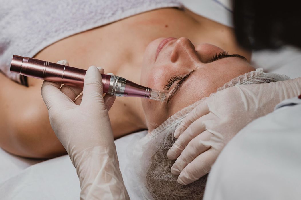 microneedling-2.jpg