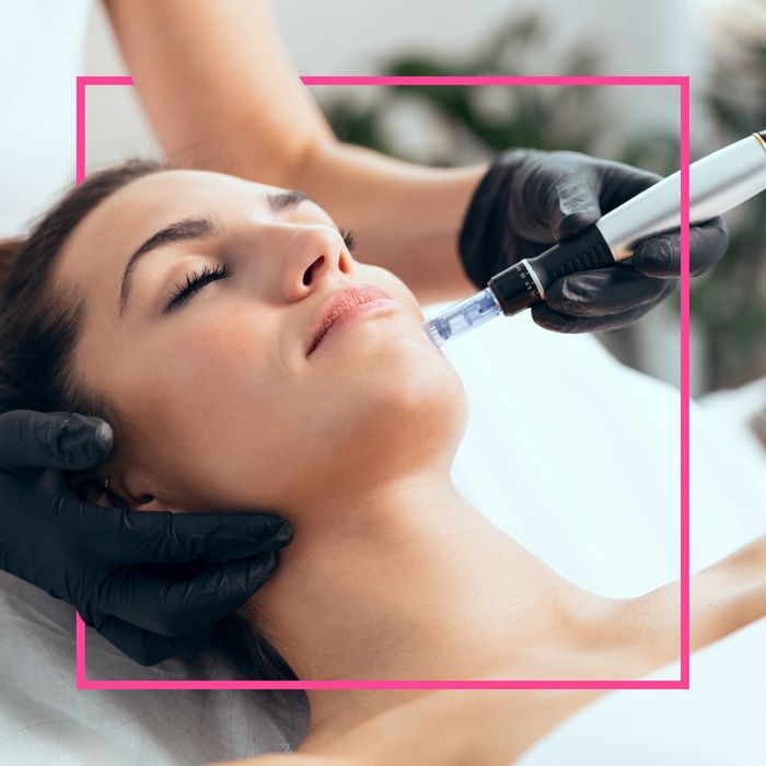 Micro-Needling - Image 3.jpg