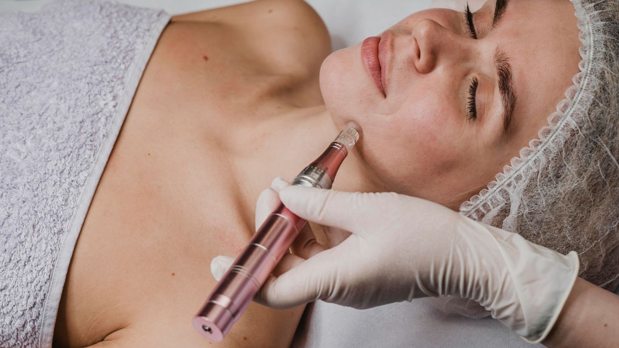 microneedling.jpg