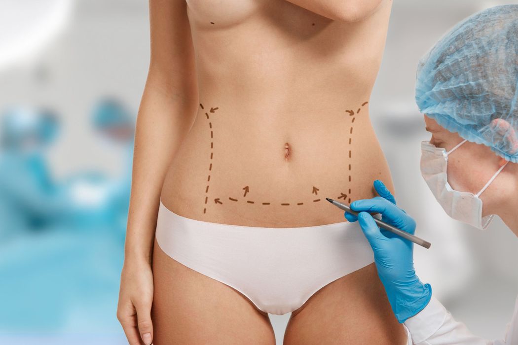 body-contouring.jpg