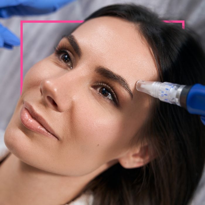 Micro-Needling - Image 4.jpg