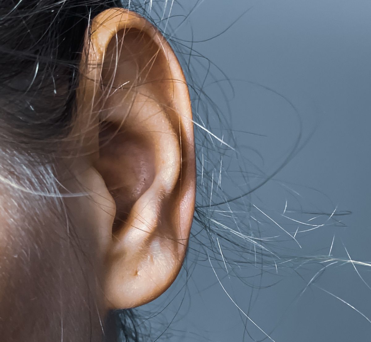 A woman's ear, possibly in need of What is Ear Pinning (Otoplasty) Surgery in Cincinnati