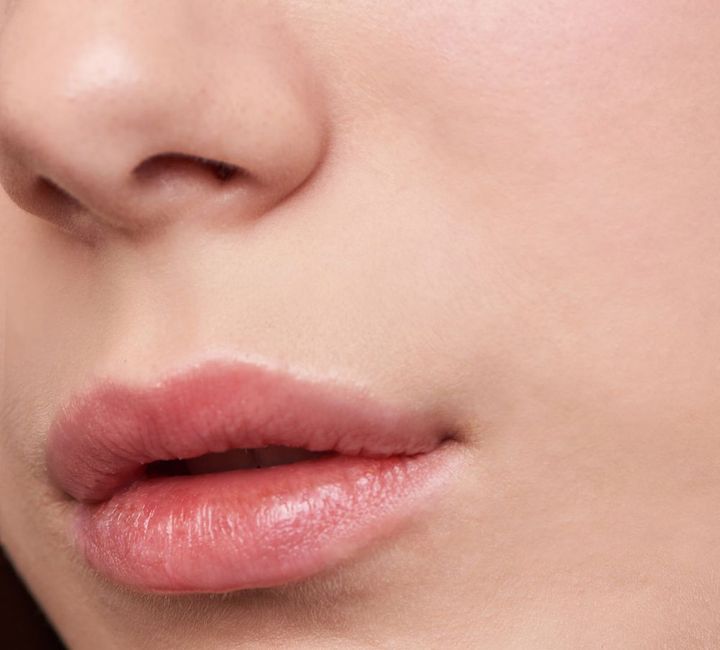 peri-oral rejuvenation in Cincinnati