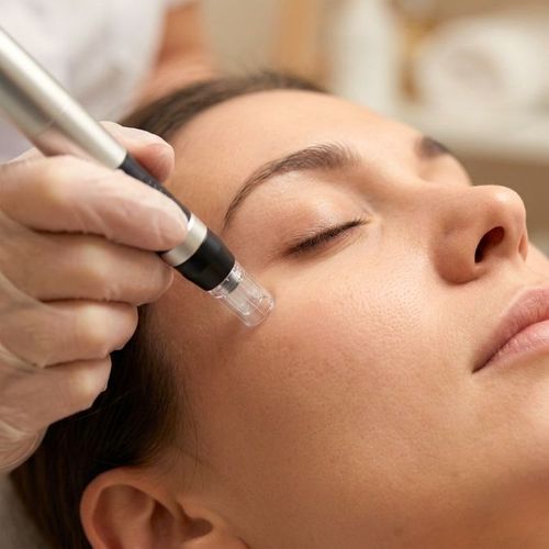 Microneedling