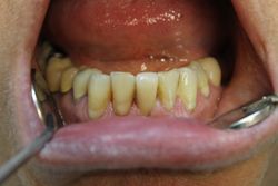 After: Final Restoration