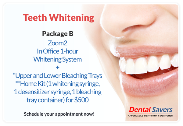 Teeth Whitening package B