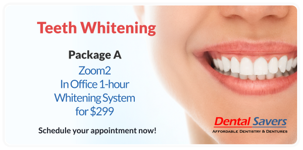 Teeth Whitening package A