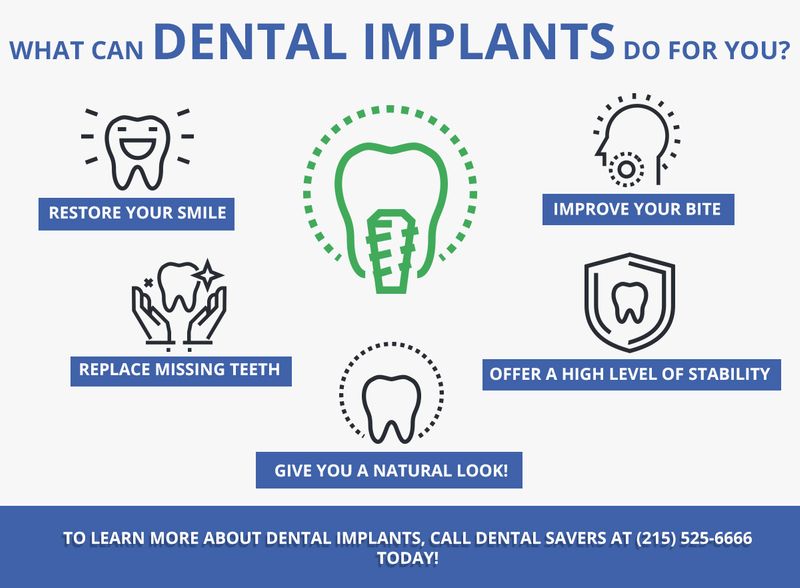 Dental-Implants-5c05b61a3f87c.jpg