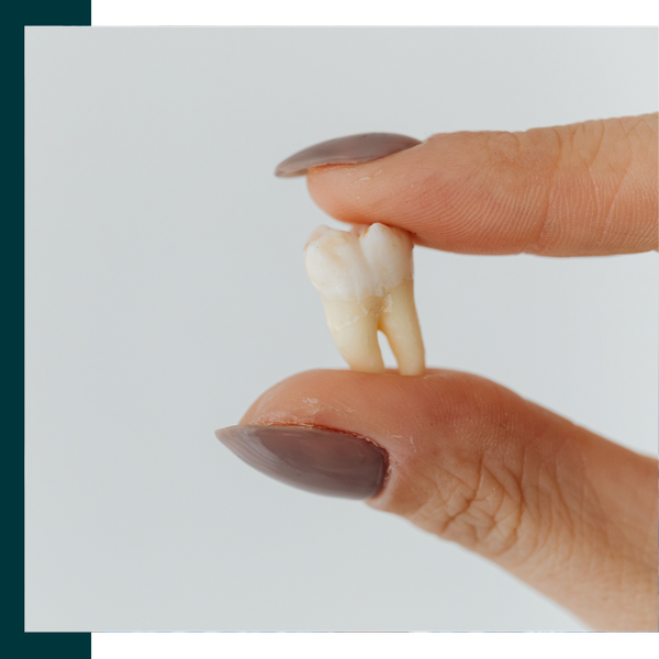 Tooth Extraction 4.png