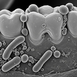 A magnified view of bacterial plaque near the gumline. A magnified view of bacterial plaque near the gumline.