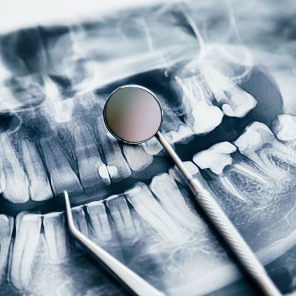 Dental X-ray with mirror and dental tool on top