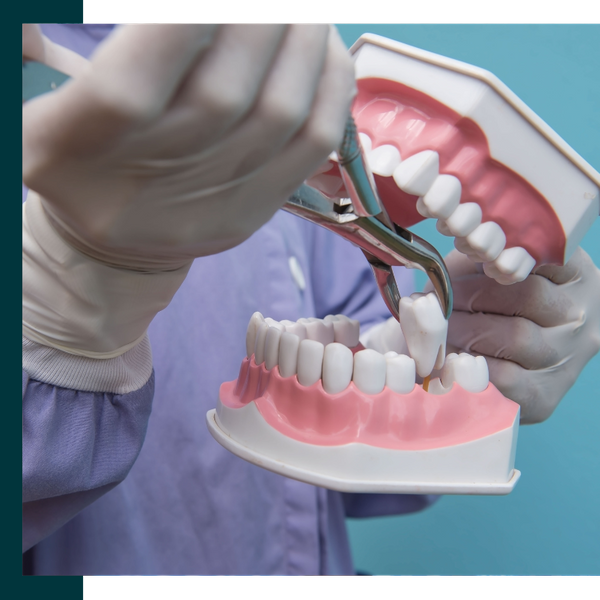 Tooth Extraction 2.png