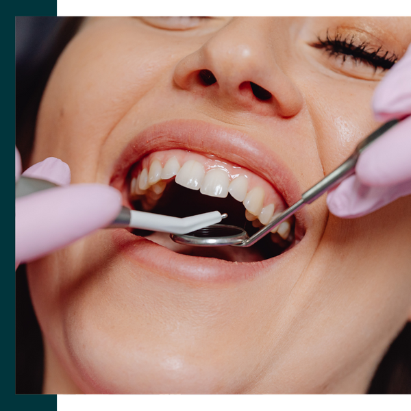 person getting their teeth inspected Blog 1.png