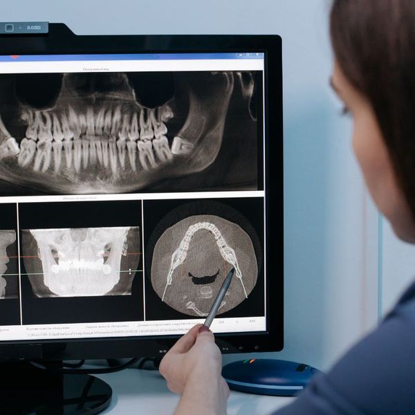 Dentist pointing at dental X-ray on computer screen