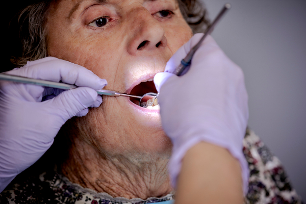 Gum-Health-Alzheimers.jpg