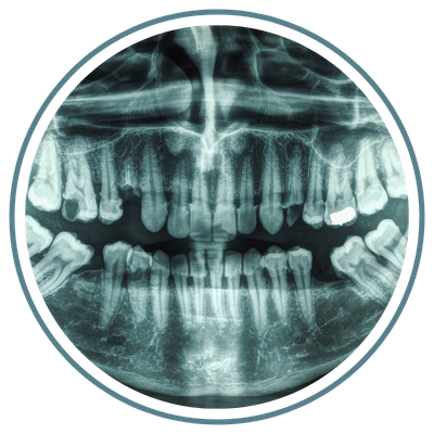 dental x-ray