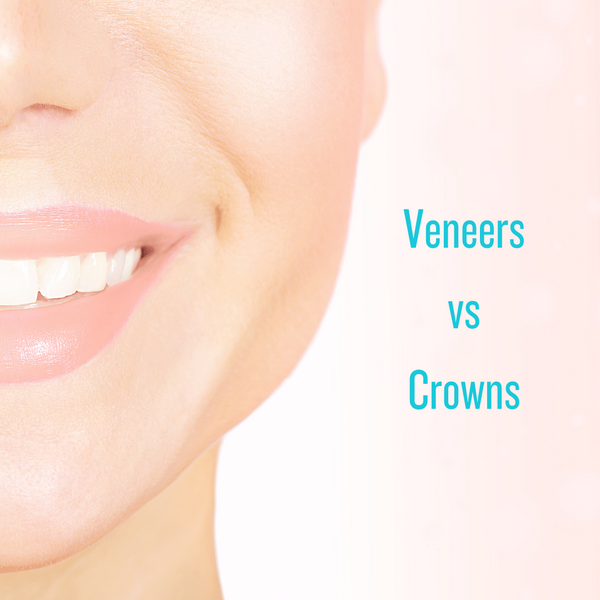 veneers vs crowns.png