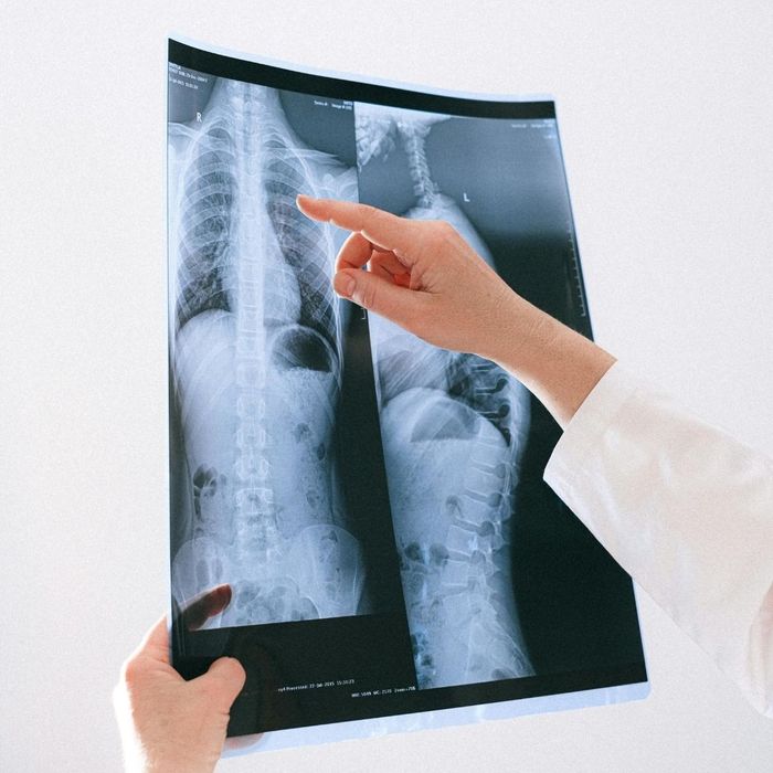 Doctor looking at an xray