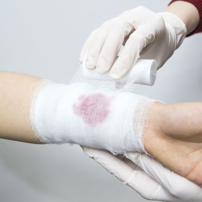 A person with a cut on their wrist