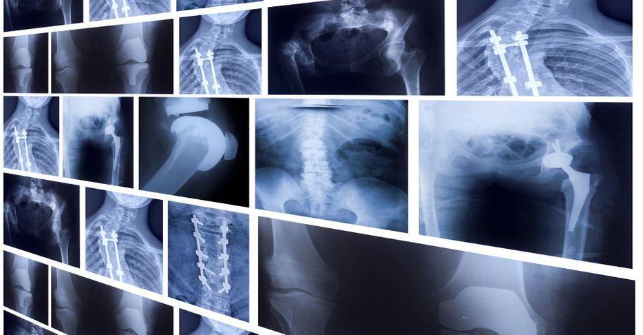 Top-notch X-ray Services at Best Remedy Urgent Care.jpg