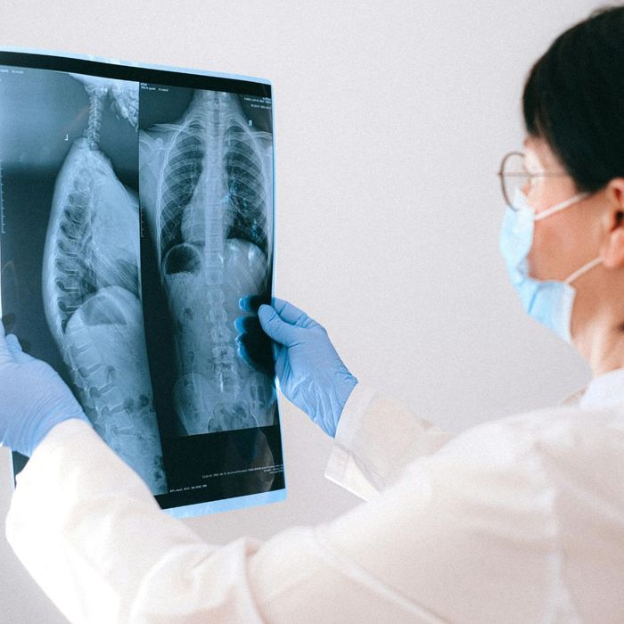 Viewing an xray