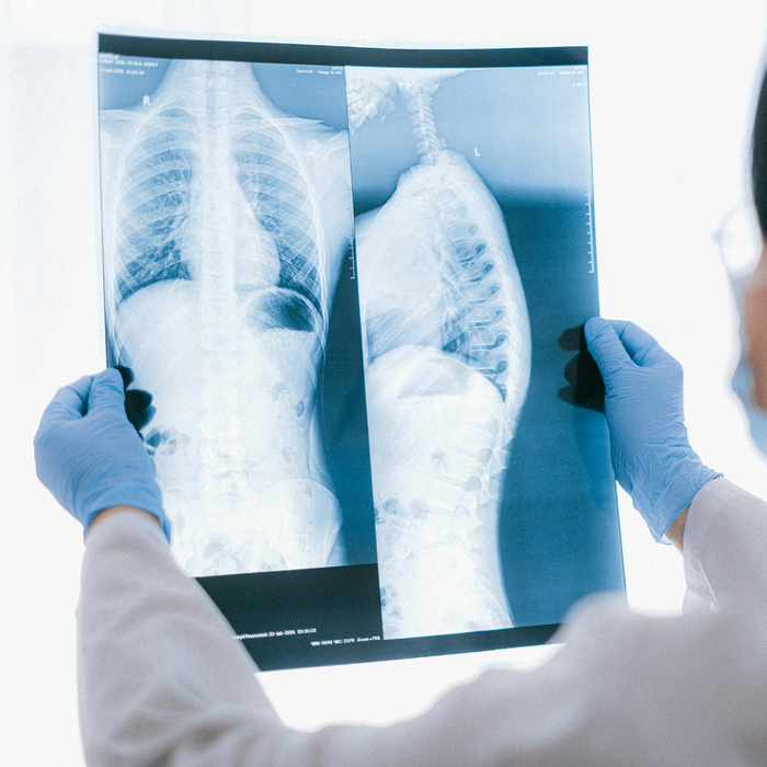 X ray