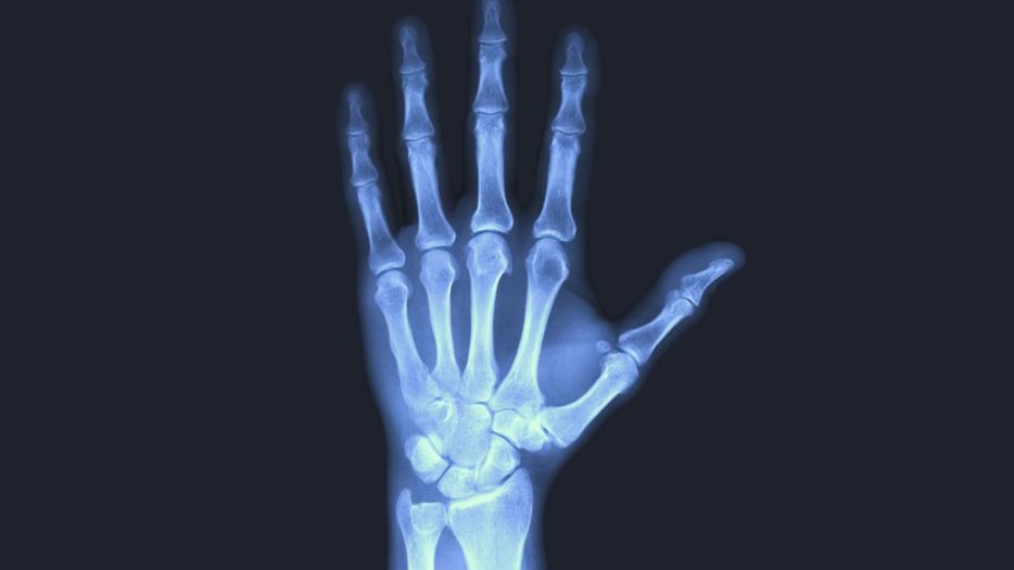 Why You Can Place Your Trust in X-Ray Services from Best Remedy Urgent Care.jpg