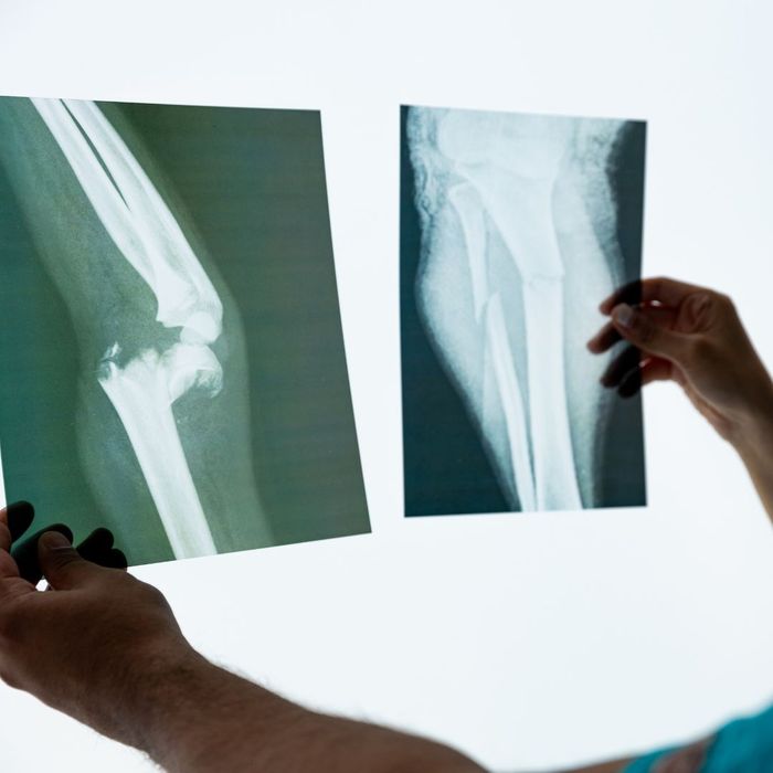 Viewing x rays
