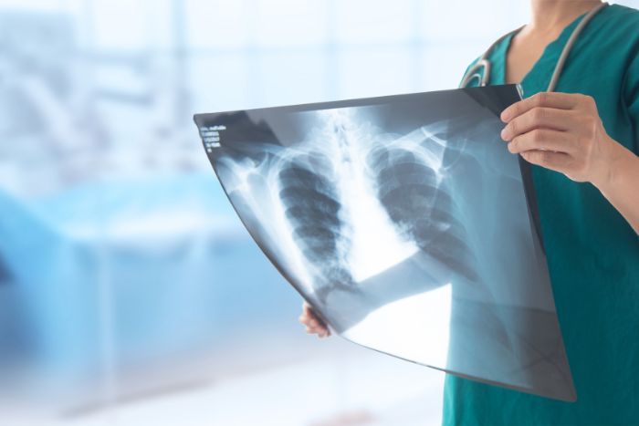 physician holding x-ray file