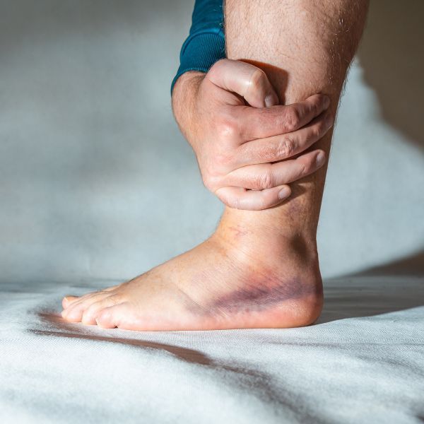 A person with a sprained ankle