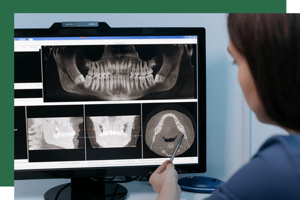 person looking at computer scanned dental impressions