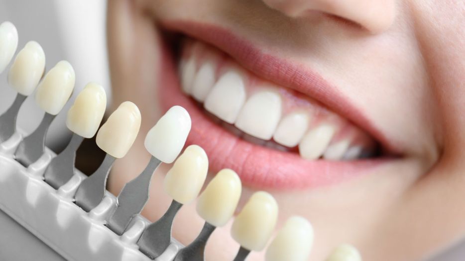 Woman choosing color of teeth at dentist 