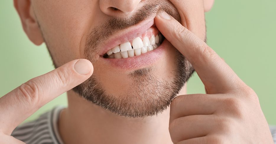 Gap in teeth