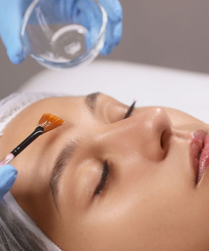 Person getting a chemical peel