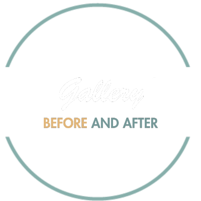 Gallery.png