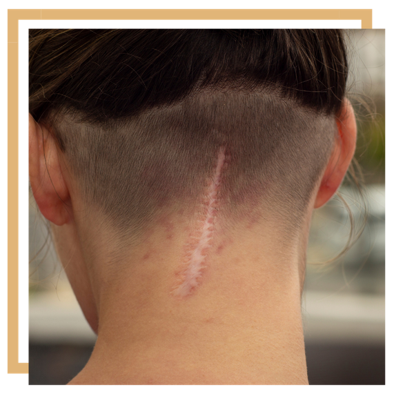 scar 3.png