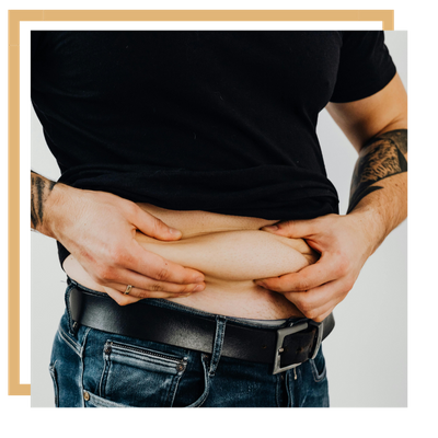 a man squeezing his belly fat Vaser Lipoabdominoplasty.png