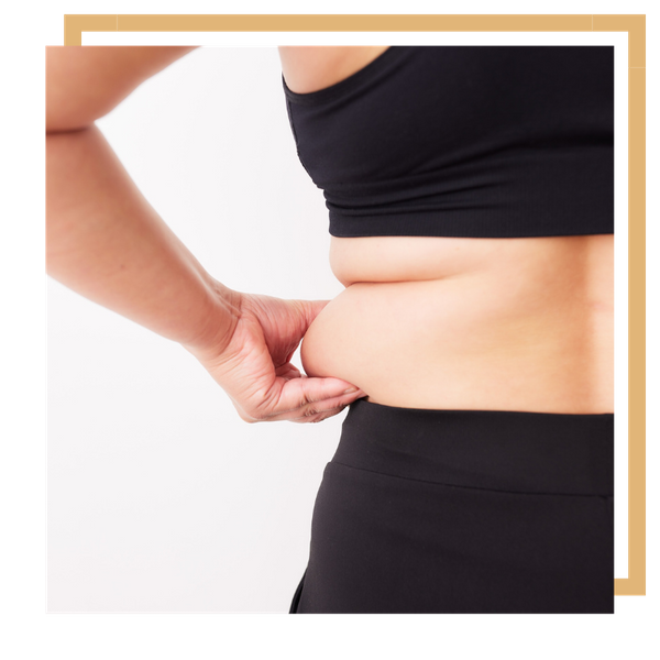 a person with belly fat Vaser Lipoabdominoplasty (2).png